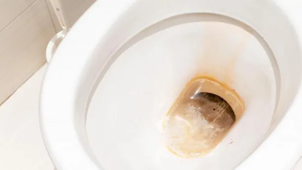 inodoro-mancha-marronjpg