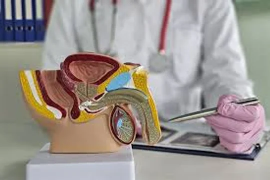 Vasectomía