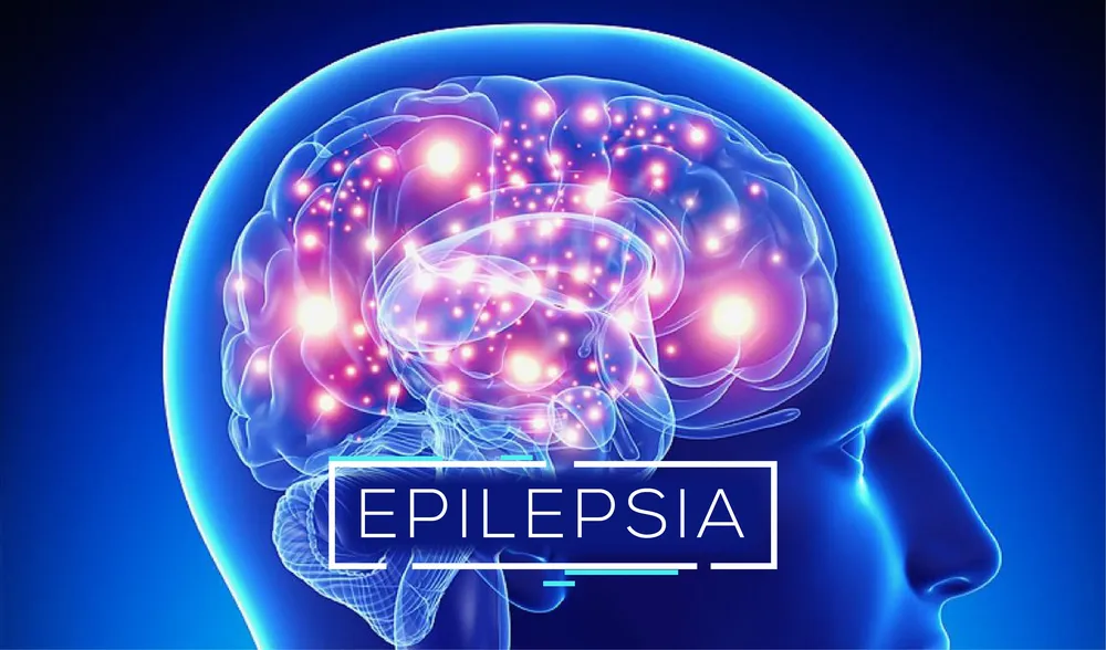 EPILEPSIAS