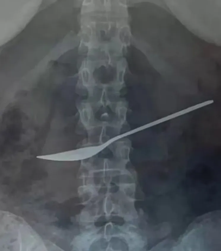 cuchara_1.jpg_1026276303