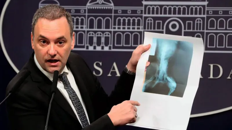 Pensión por invalidez 