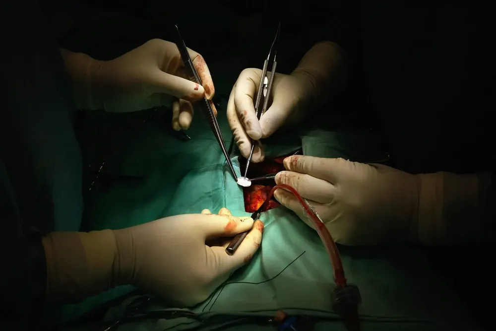 Intervención cardiovascular