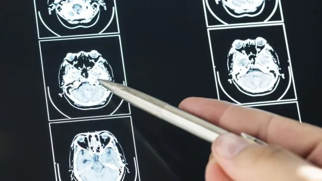 Cerebro