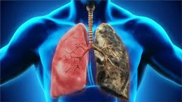 enfermedades respiratorias  