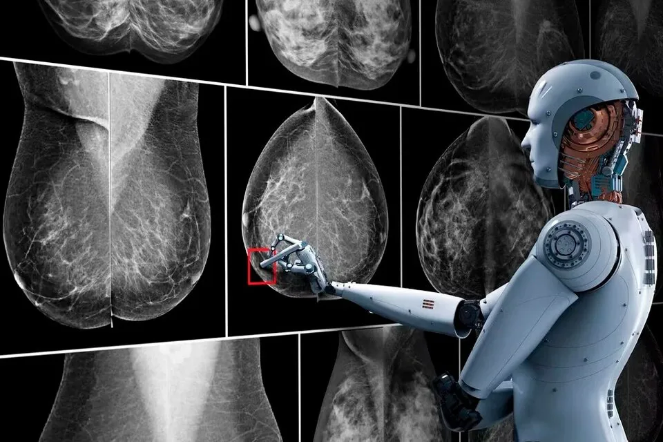 Cáncer de mama inteligencia artificial