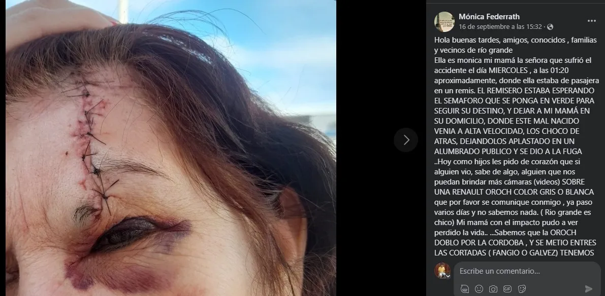 Mujer herida choque Av San Martín